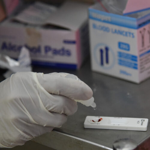 Only 25–30% of the people affected by Hepatitis B and C in Pakistan know it, meaning the vast majority do not undergo testing and do not seek life-saving treatment. Photo: WHO Pakistan/Sara Akmal
